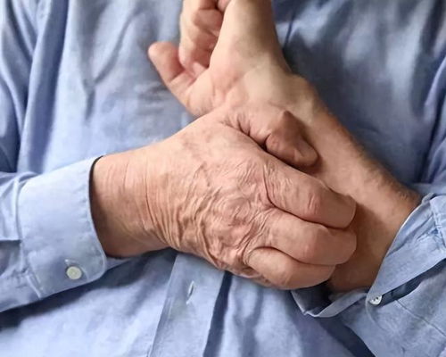 脚气难愈或因入误区 中医治疗脚气有妙招 脚气难愈或因入误区 中医治疗脚气有妙招