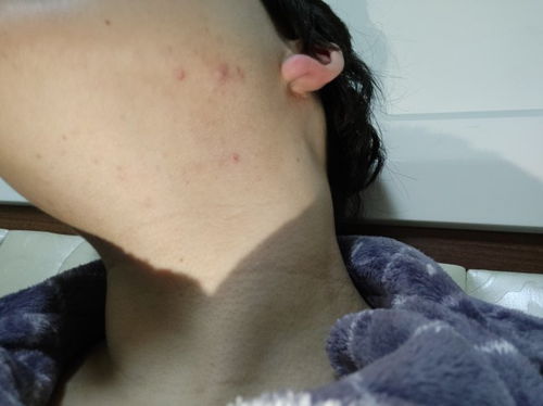 月经紊乱会导致什么后果 月经紊乱会导致什么后果