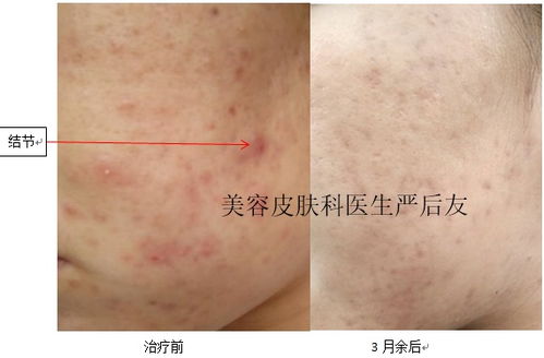 吃芒果过敏该怎么办 吃芒果过敏该怎么办