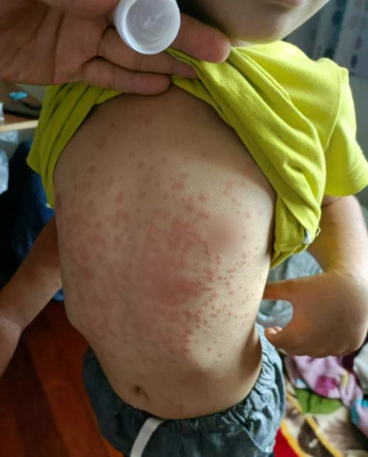 ��������ţƤѢר��ҽԺ�ļҺ�