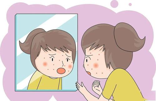 湿疹的发病原因是啥 湿疹的发病原因是啥