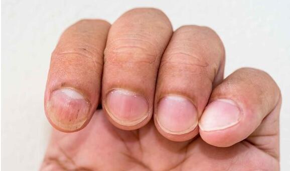 �����ĸ��εú�ţƤѢ