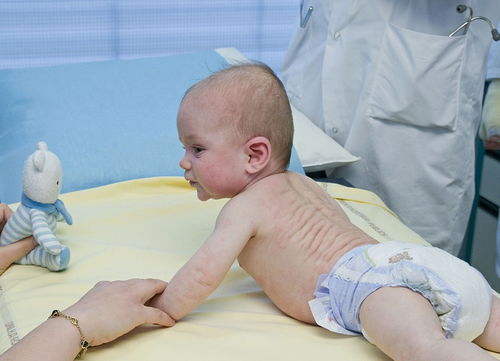 灰指甲吃什么好 两个偏方不妨一试 灰指甲吃什么好 两个偏方不妨一试