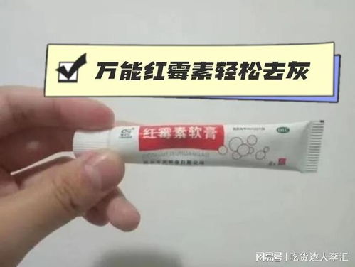 如何防治脚气 如何防治脚气