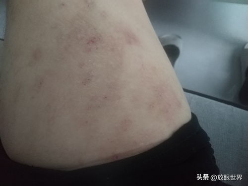 Ѱ����ţƤѢ��Σ������Щ