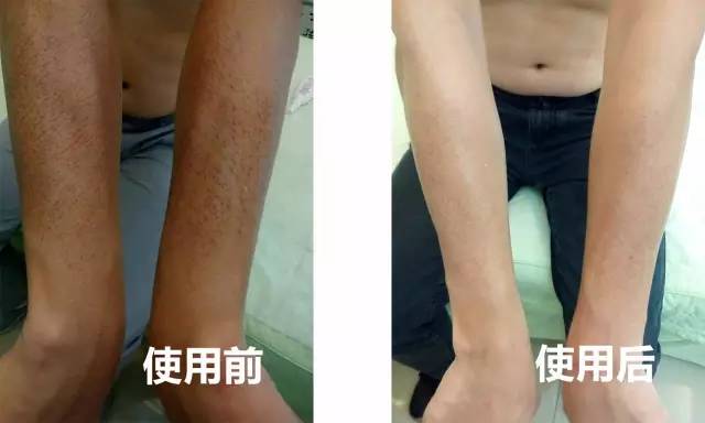 ����ţƤѢ�����ڼ��������