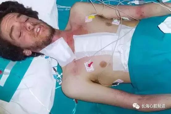 肾虚会出现什么症状 肾虚会出现什么症状