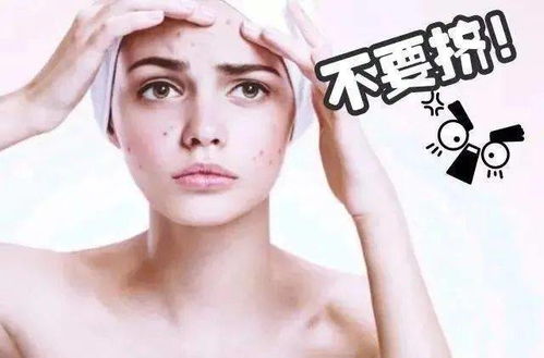 黏膜牛皮癣的症状 黏膜牛皮癣的症状