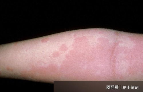 ����ţƤѢ�ļ�鷽������ʲô