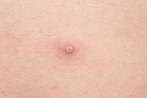 �����ļ���ţƤѢ��רҵ ���Ԥ���＾ţƤѢ����