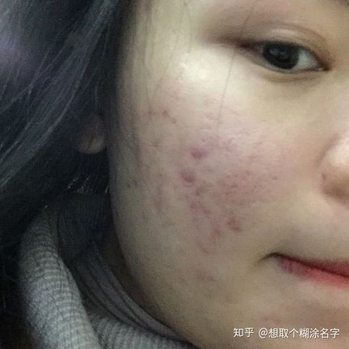 ��������ţƤѢ�ļҺ� ţƤѢ����Խ��Խ��Ϊʲô