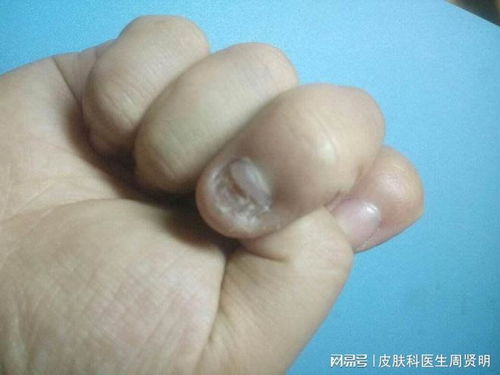 ������ţƤѢ��Ӧ��Щ����