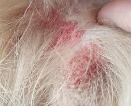 男性尿酸高的症状有哪些 男性尿酸高的症状有哪些