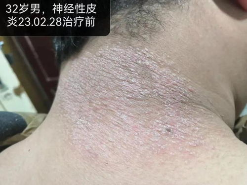 ����ţƤѢ��ԭ��