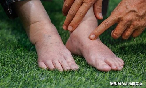 ƤѢ����֢״ͼƬ ţƤѢһ��ʼ��ʲô֢״