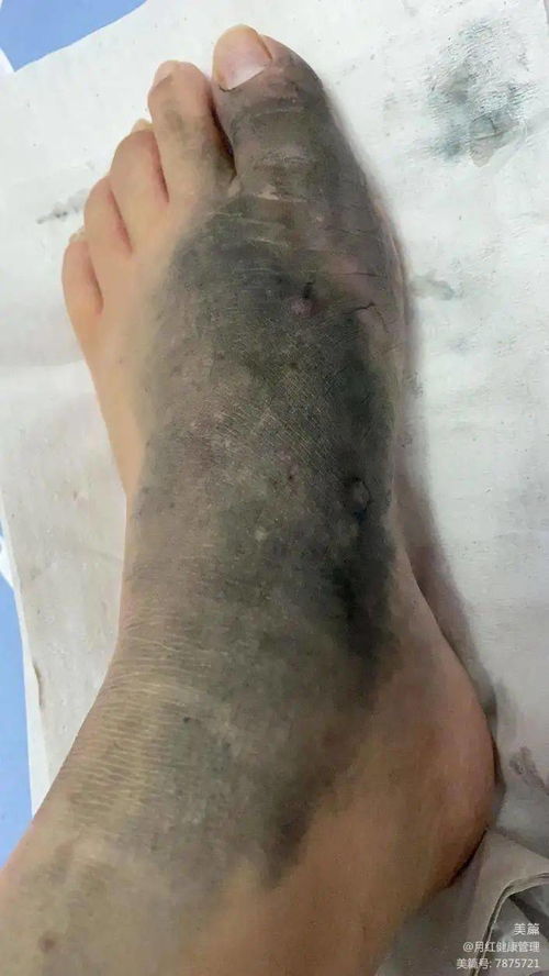 女生来姨妈能喝茶吗 女生来姨妈能喝茶吗