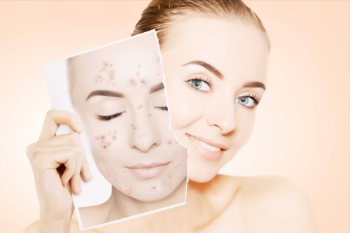 要怎么预防灰指甲 要怎么预防灰指甲