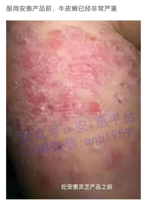 王俊凯多高_王俊凯多高2025 王俊凯多高_王俊凯多高2025