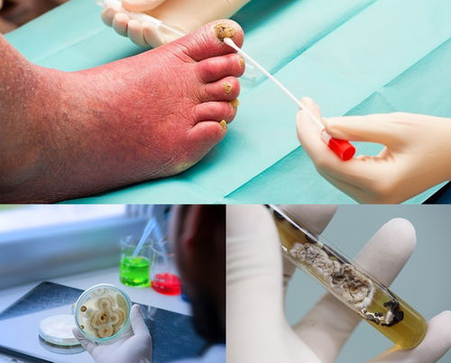 肾上腺激素分泌过多的症状 肾上腺激素分泌过多的症状