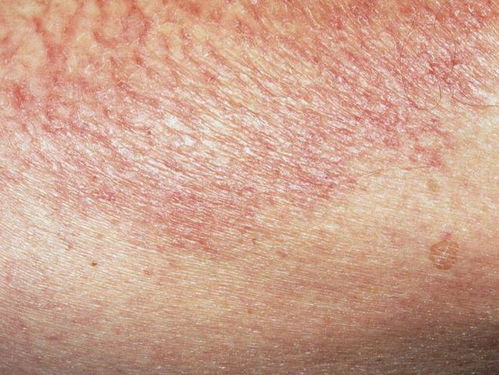 Ӥ�����ж���Ż����