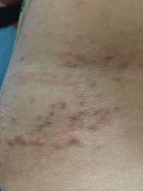 女性有口臭是什么原因 女性有口臭是什么原因