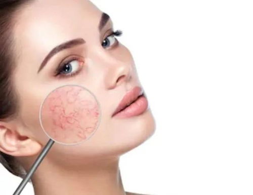 艾滋病检测阳性正常吗 艾滋病检测阳性正常吗