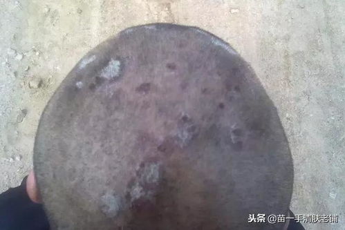 诱发脚气的病因有什么 诱发脚气的病因有什么