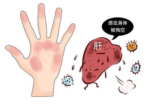 皮肤湿疹不能吃什么呢 皮肤湿疹不能吃什么呢