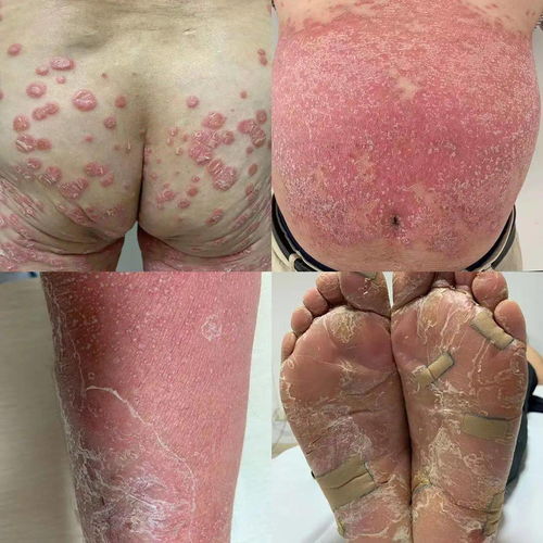 ȥĸţƤѢ ţƤѢʲôӰ