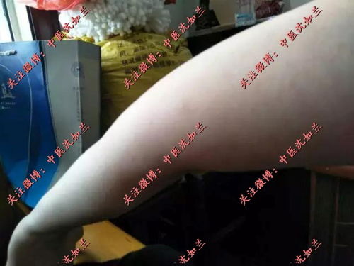 百多邦治脚气吗 百多邦治脚气吗