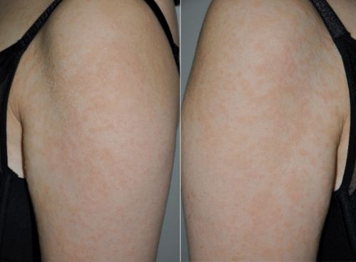 ţƤѢ�߲��˽���ҩԡ��11���