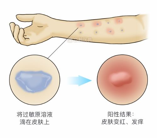 原来食醋也可以治脚气 原来食醋也可以治脚气