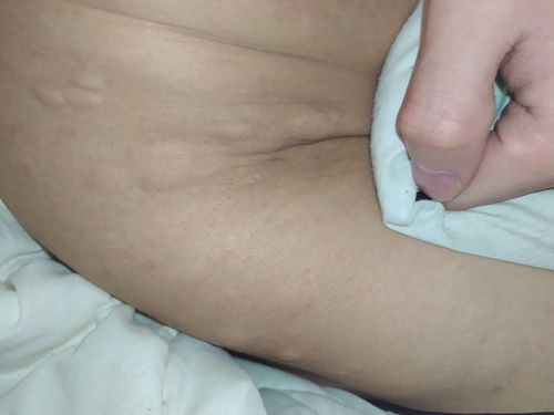 ��ͯƤ��ѢͼƬ���� ��ͯ��ţƤѢʲôԭ������� 