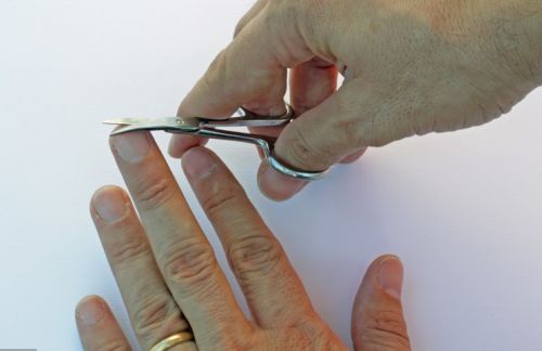 湿疹全身治疗用什么药物 湿疹全身治疗用什么药物