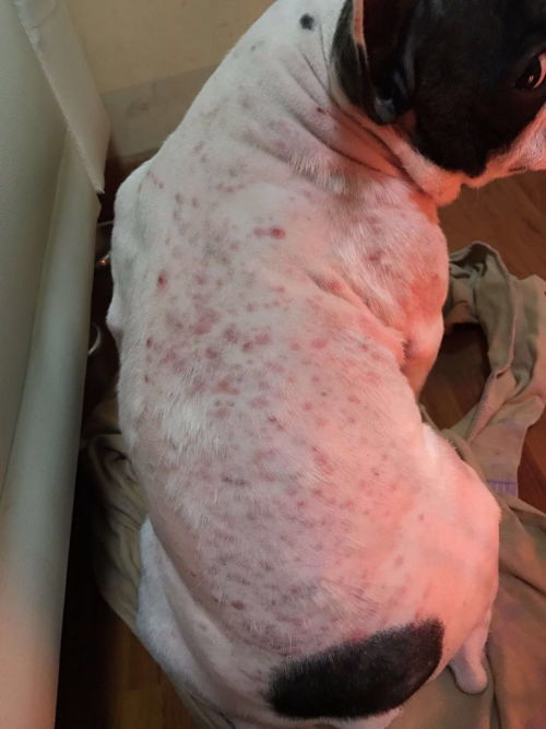 阴虱子是怎么形成的 阴虱子是怎么形成的