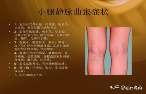 怎么判断过敏还是湿疹 怎么判断过敏还是湿疹