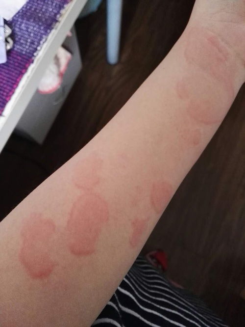 身体突然消瘦有哪些原因 身体突然消瘦有哪些原因