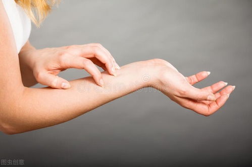 辽宁沈阳牛皮癣辽宁沈阳可以治疗牛皮癣的专科 辽宁沈阳牛皮癣辽宁沈阳可以治疗牛皮癣的专科