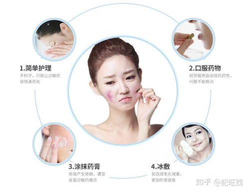 急性荨麻疹注意事项有哪些 急性荨麻疹注意事项有哪些