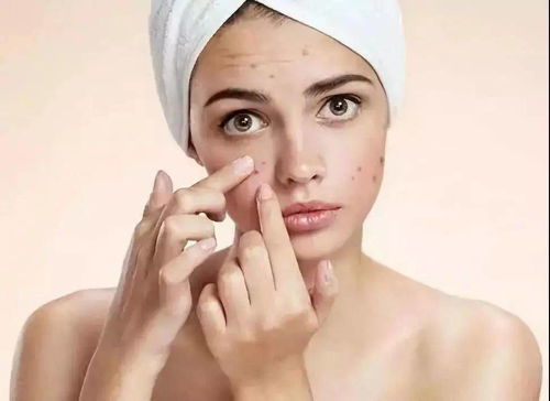 治疗灰指甲的民间小偏方 治疗灰指甲的民间小偏方