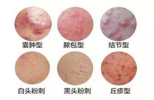 ţƤѢ���鷴�����ֹ����