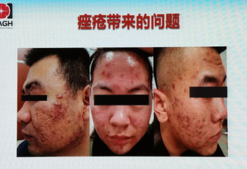 ȩӰ콡ƤӦ 2025ȩݡо¹۲