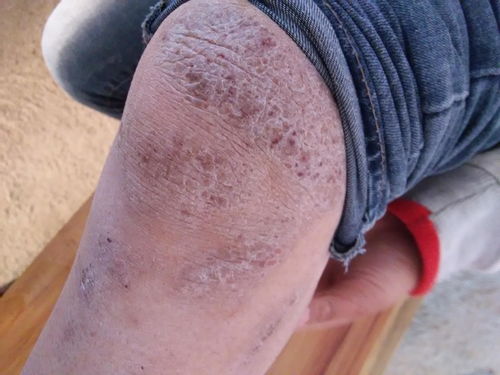 女子便秘吃什么 女子便秘吃什么