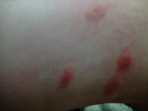 ͭ�ʵ�����ţƤѢЧ���� ţƤѢ�Թؽ�������