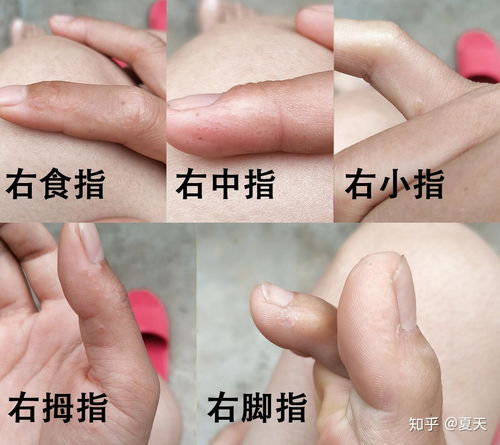 Ϻһ3¥ֳŨ̹ ˴Ӷ¥ºҽ