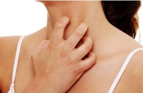 哺乳期怎样治疗脚气 哺乳期怎样治疗脚气