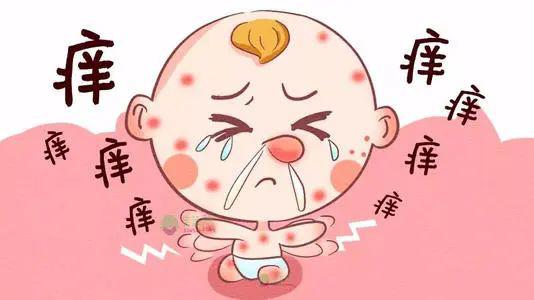 小孩天热湿疹怎么办 小孩天热湿疹怎么办