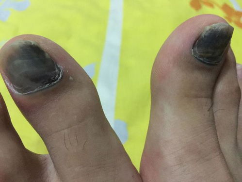 红脸怎么治 红脸怎么治