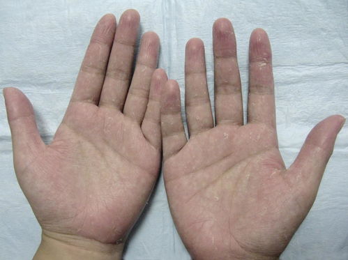 徐州伏羊节(徐州伏羊节来历简介) 徐州伏羊节(徐州伏羊节来历简介)