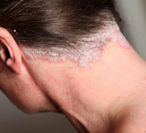 舌头毛病挂什么科 舌头毛病挂什么科